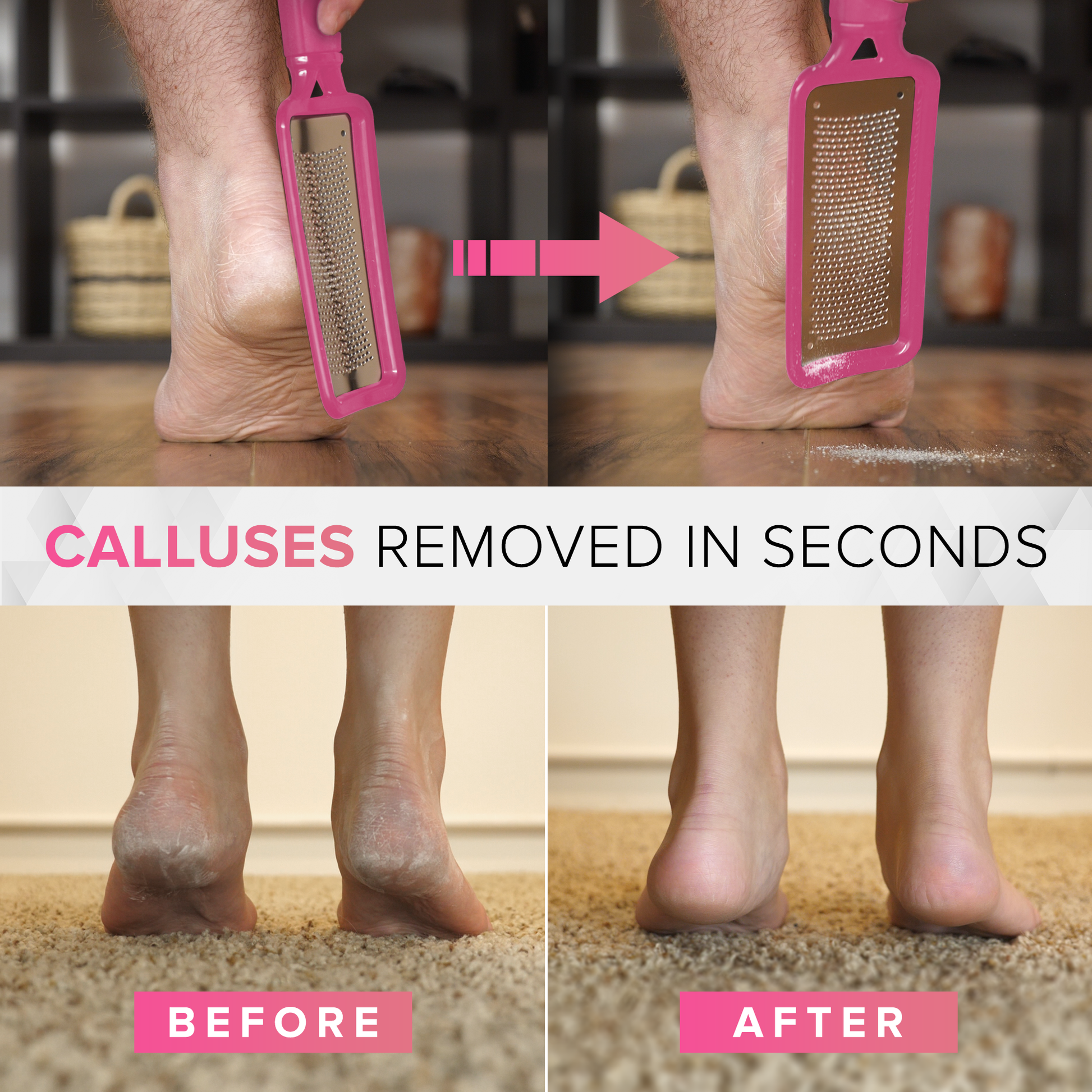 Megafile Foot File Rasp removes hard skin on feet, Callus Scraper Feet